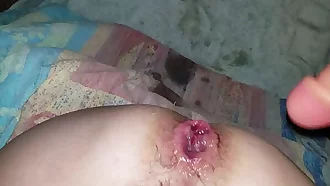 Ass busted open